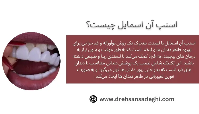 اسنپ آن اسمایل