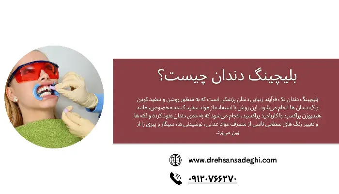 بلیچینگ دندان