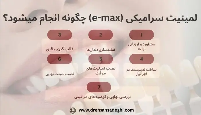 لمینیت سرامیکی (e-max) 