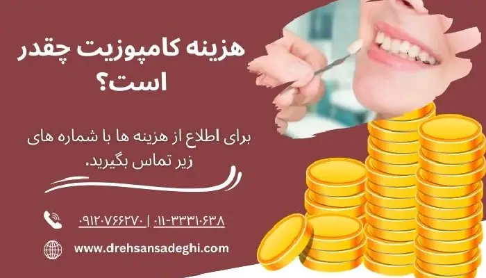 هزینه کامپوزیت