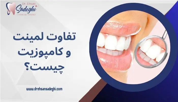 تفاوت لمینت و کامپوزیت
