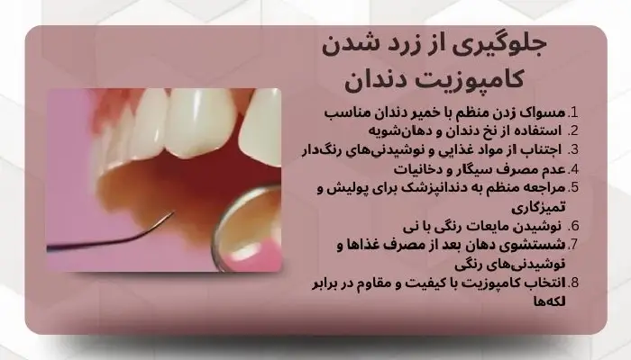 زرد شدن کامپوزیت دندان
