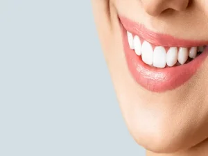سفید کردن کامپوزیت