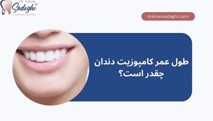 طول عمر کامپوزیت دندان