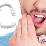 درد لمینت دندان
