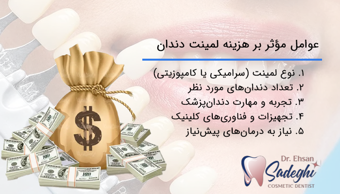 لیستی از عوامل مؤثر بر هزینه لمینت دندان