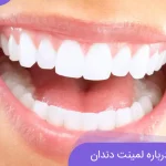 لمینت دندان برای چه کسانی مناسب است