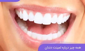 لمینت دندان برای چه کسانی مناسب است