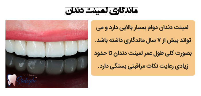 دوام و ماندگاری لمینت دندان