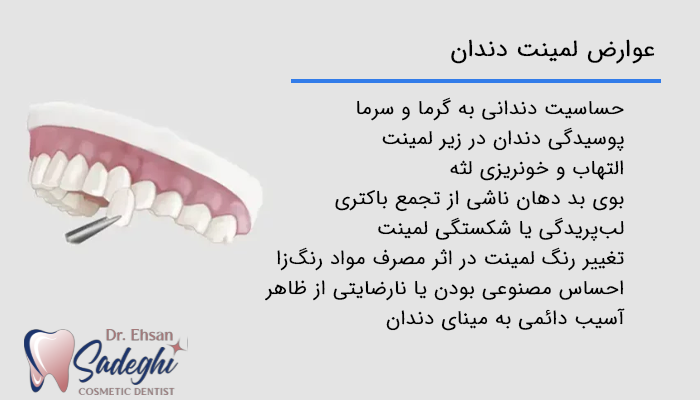 عوارض لمینت دندان