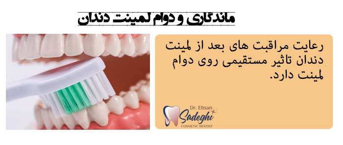 ماندگاری و دوام لمینت دندان