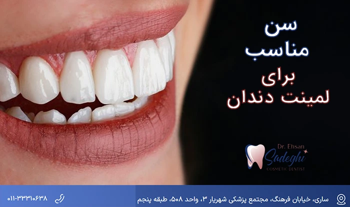سن مناسب برای لمینت دندان