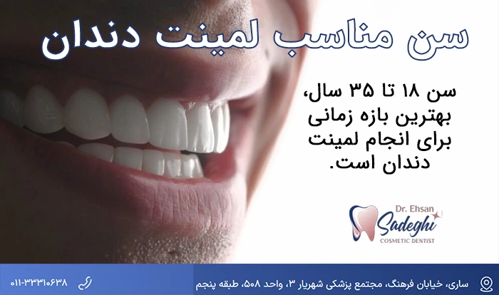 سن لمینت دندان
