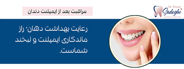 مراقبت بعد از ایمپلنت دندان