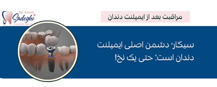 مراقبت بعد از ایمپلنت
